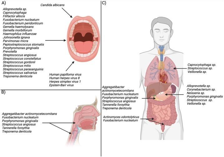 tumorigenesi e microbiota orale